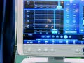 中原醫(yī)療器械展覽會--GE呼吸機CARESCAPE R860(河南融通醫(yī)療)
